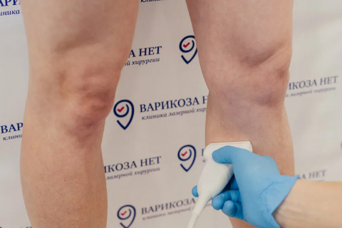 Прием хирурга-флеболога всего 590 р.
